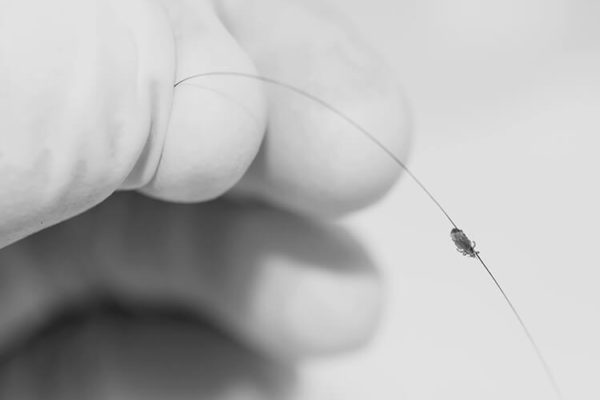 Image of a hair follicle with one head lice bug on it